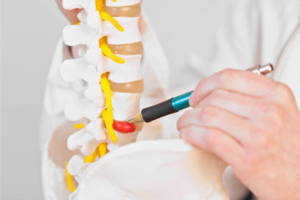 tratamiento hernia discal granada