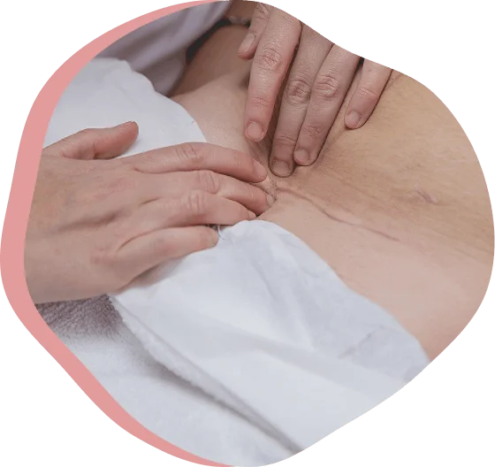 fisioterapia para diastasis abdominal